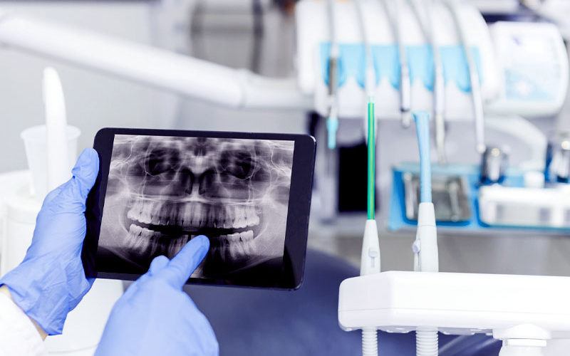 dentist hand pointing to teeth x-ray on ipad